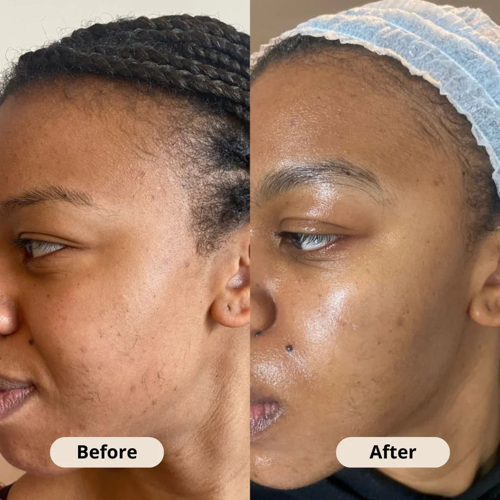 Kojic Acid Turmeric Soap